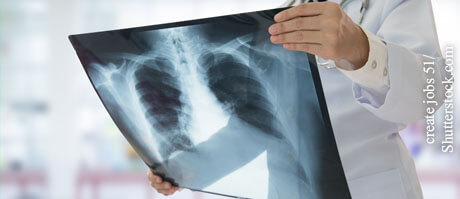  Tuberkulose ist eine Infektionskrankheit, die meist die Lunge betrifft.